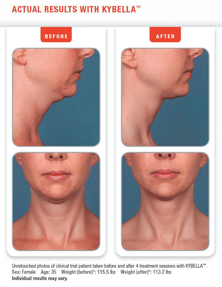 Screen Shot 2015-09-13 at 12.38.50 PM